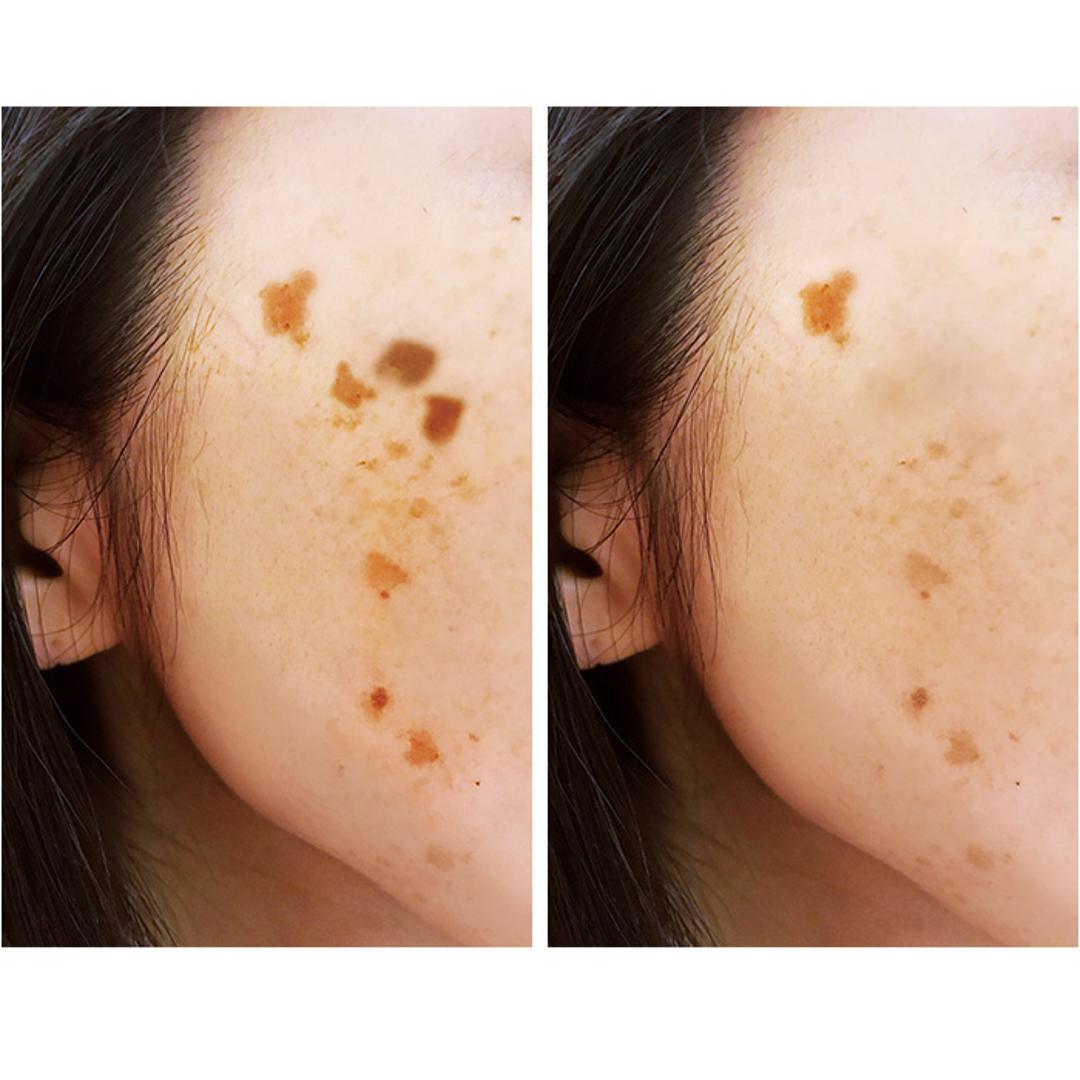 目元パック 通販 日本製 パック 目元 ナイトパッチ シート目元シート 保湿 乾燥 貼るパック アイケア 目元ケア エイジングケア 部分パック 貼るシート パックタイプ 女性 男性 目もと 目の下 アイシート プレゼント ホワイト ・