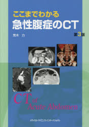 ここまでわかる急性腹症のＣＴ