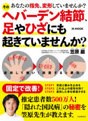 そのヘバーデン結節、足やひざにも起きていませんか？　あなたの指先、変形していませんか？