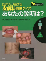 臨床力が高まる皮膚科診断クイズあなたの診断は？　上
