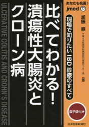 あなたも名医！比べてわかる！潰瘍性大腸炎とクローン病　現場で知りたいＩＢＤ診療のすべて