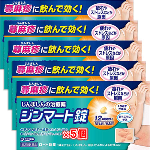【第2類医薬品】★ジンマート錠 14錠×5個セット【ロート製薬】じんましんの治療薬 蕁麻疹に飲んで効く！